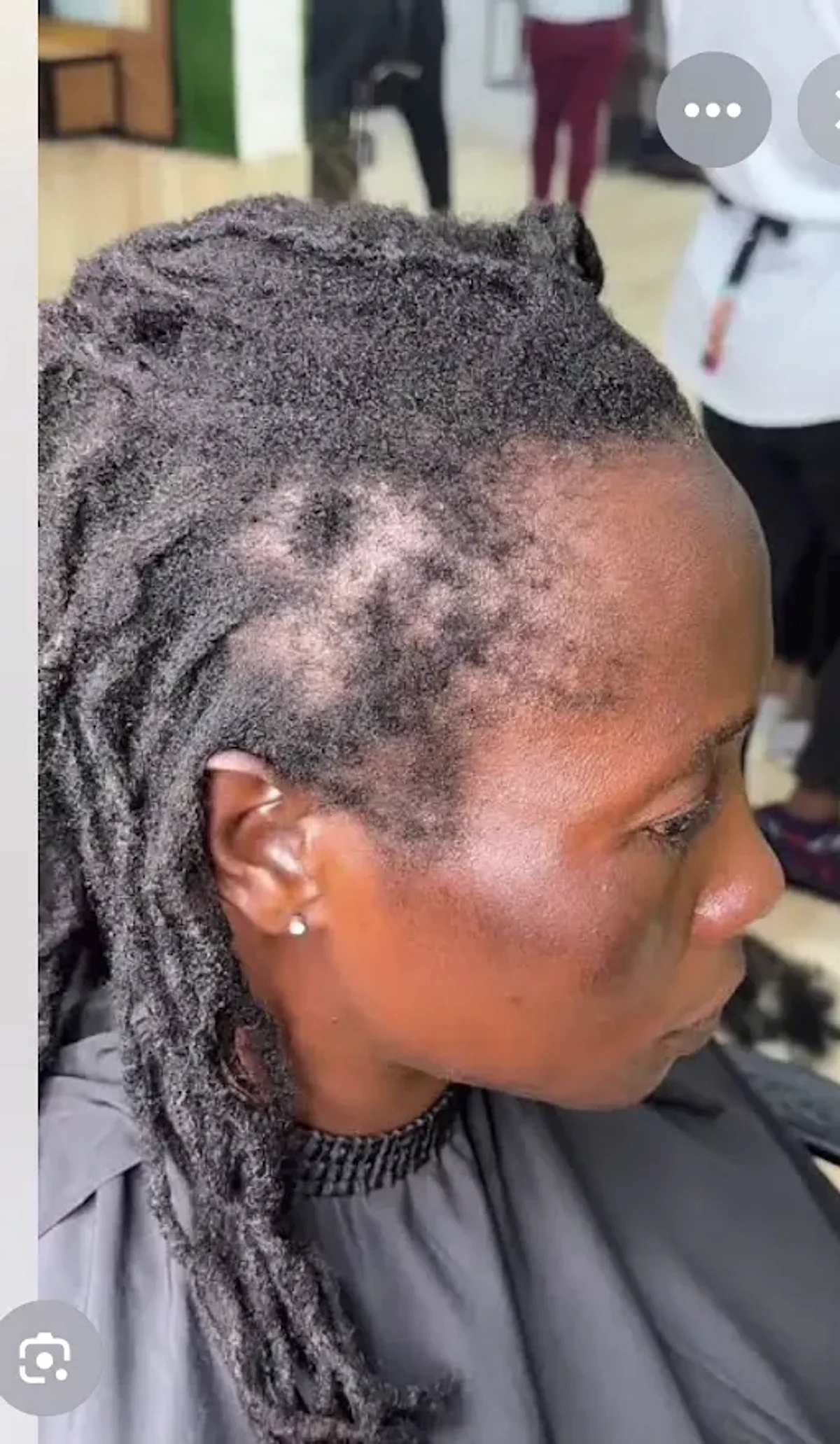 Sparse temple area and stressed loc foundation before assessment